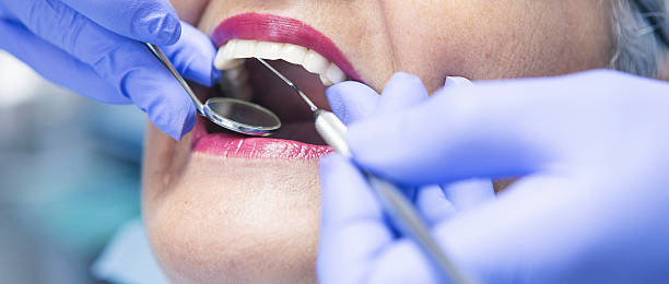 Best Dentist for Tooth Abscess  in Diamondhead, MS